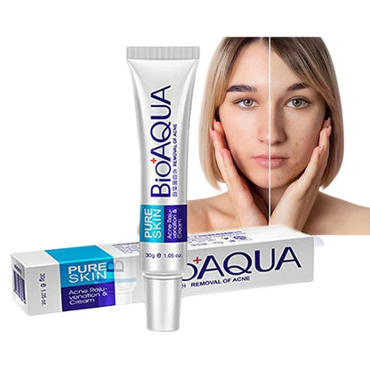 ¡Di Adiós al Acné con el Combo Anti Acné Bioaqua! 🌟 Tu Aliado en el Cuidado Facial Natural 40%OFF