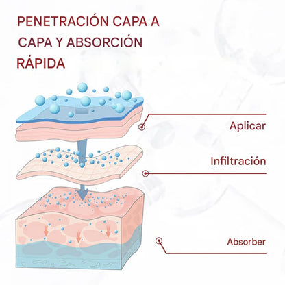 VARICOSE VEINS CREMA – COMPRA 1 Y LLÉVATE 2! ¡PIERNAS LIGERAS Y SIN DOLOR! 40%OFF